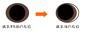 eye.jpg